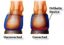 Orthotics